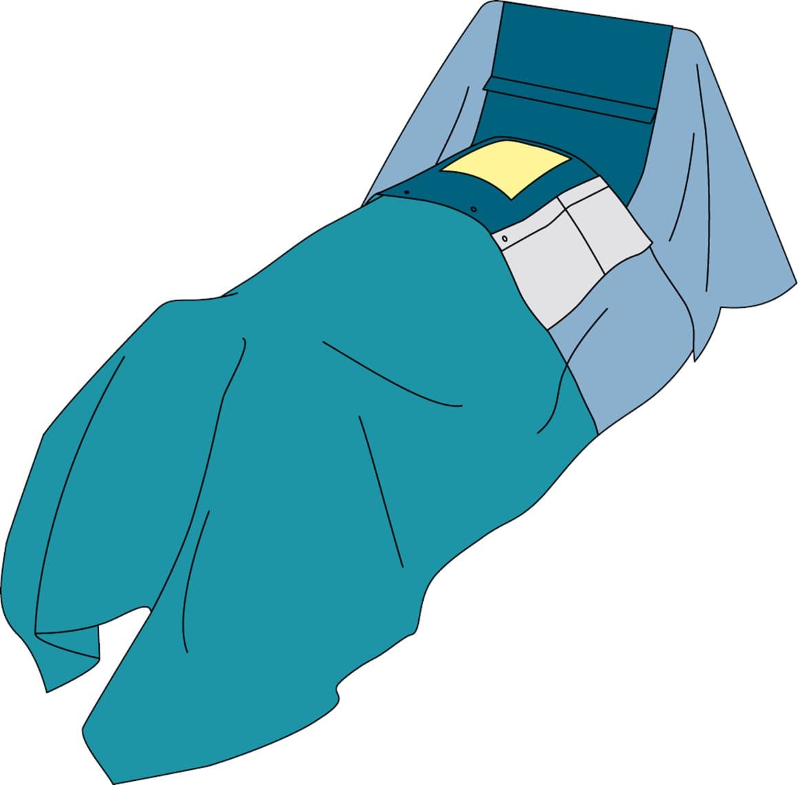Mölnlycke Thoracic drape 200/300x330cm 6stk 1
